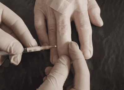 Finger joint (MCP, PIP, DIP) injections