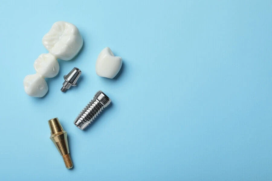 dental implants