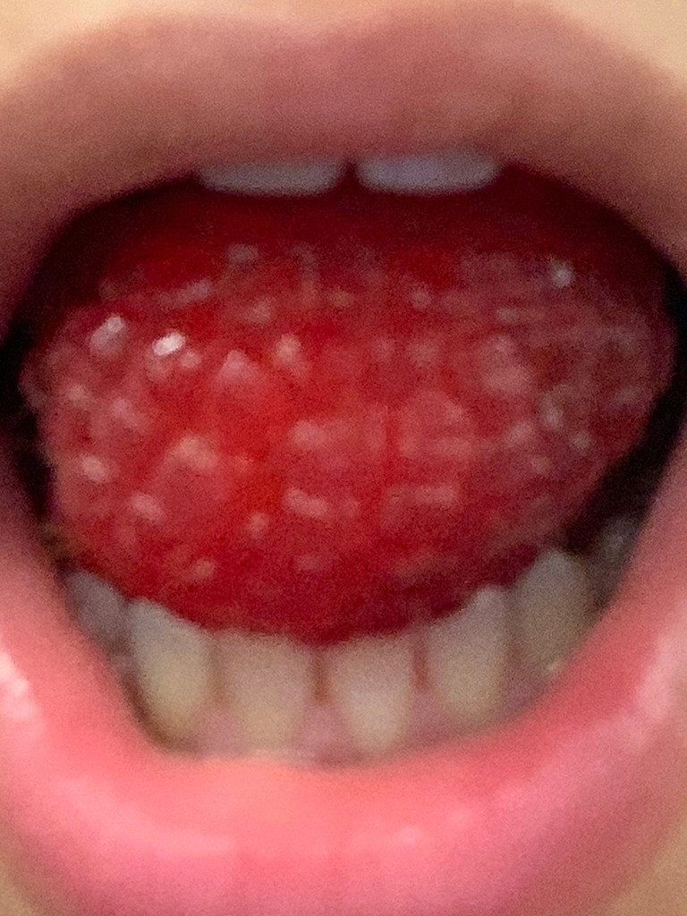 "Raspberry held in the mouth"
