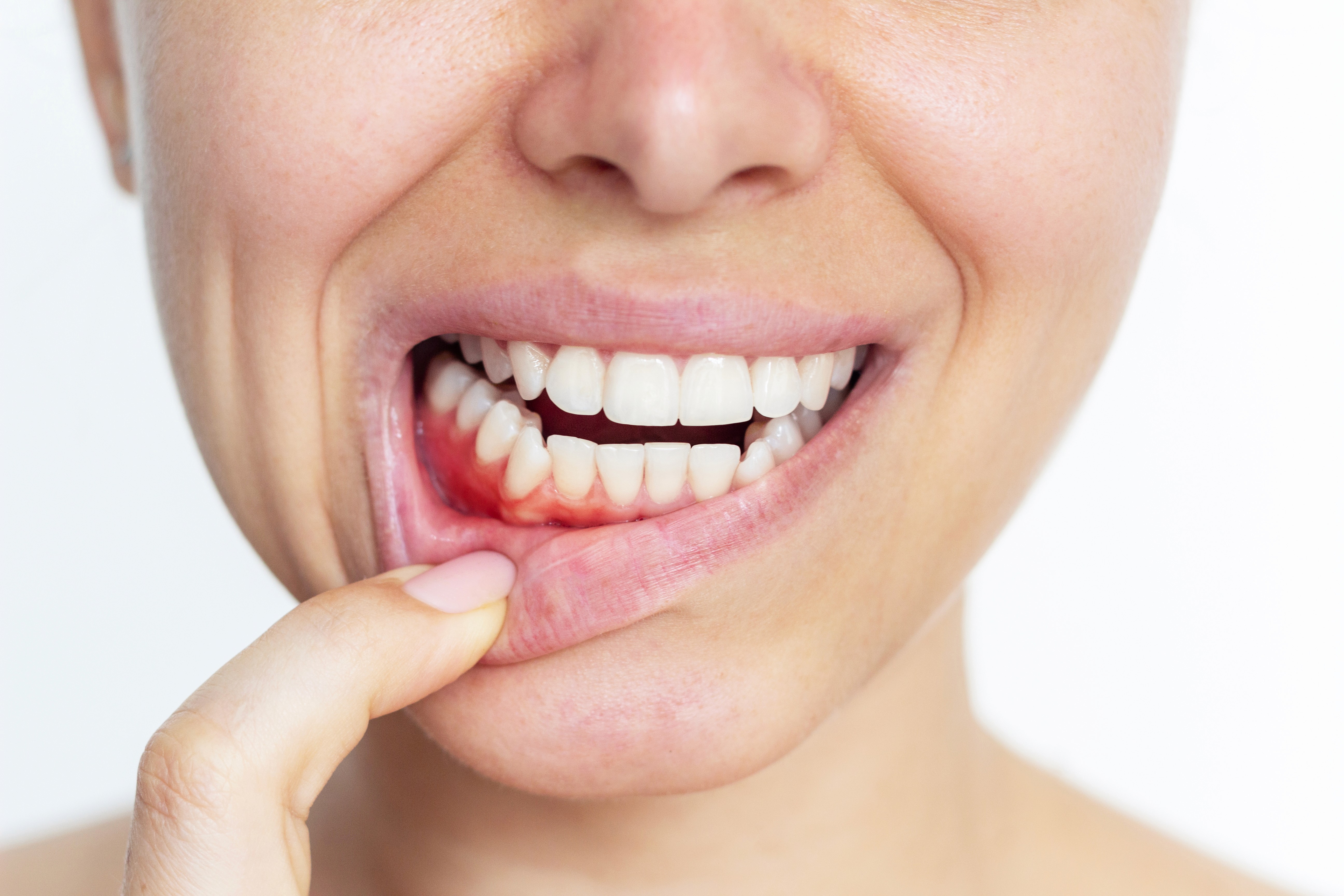 Gum Treatment & Crafting