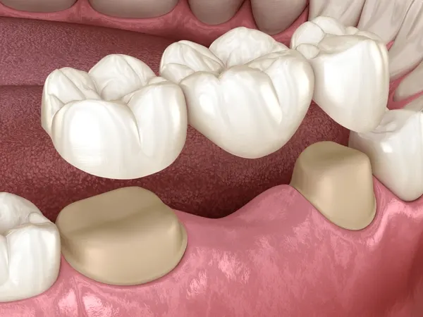 Intraoral Cameras