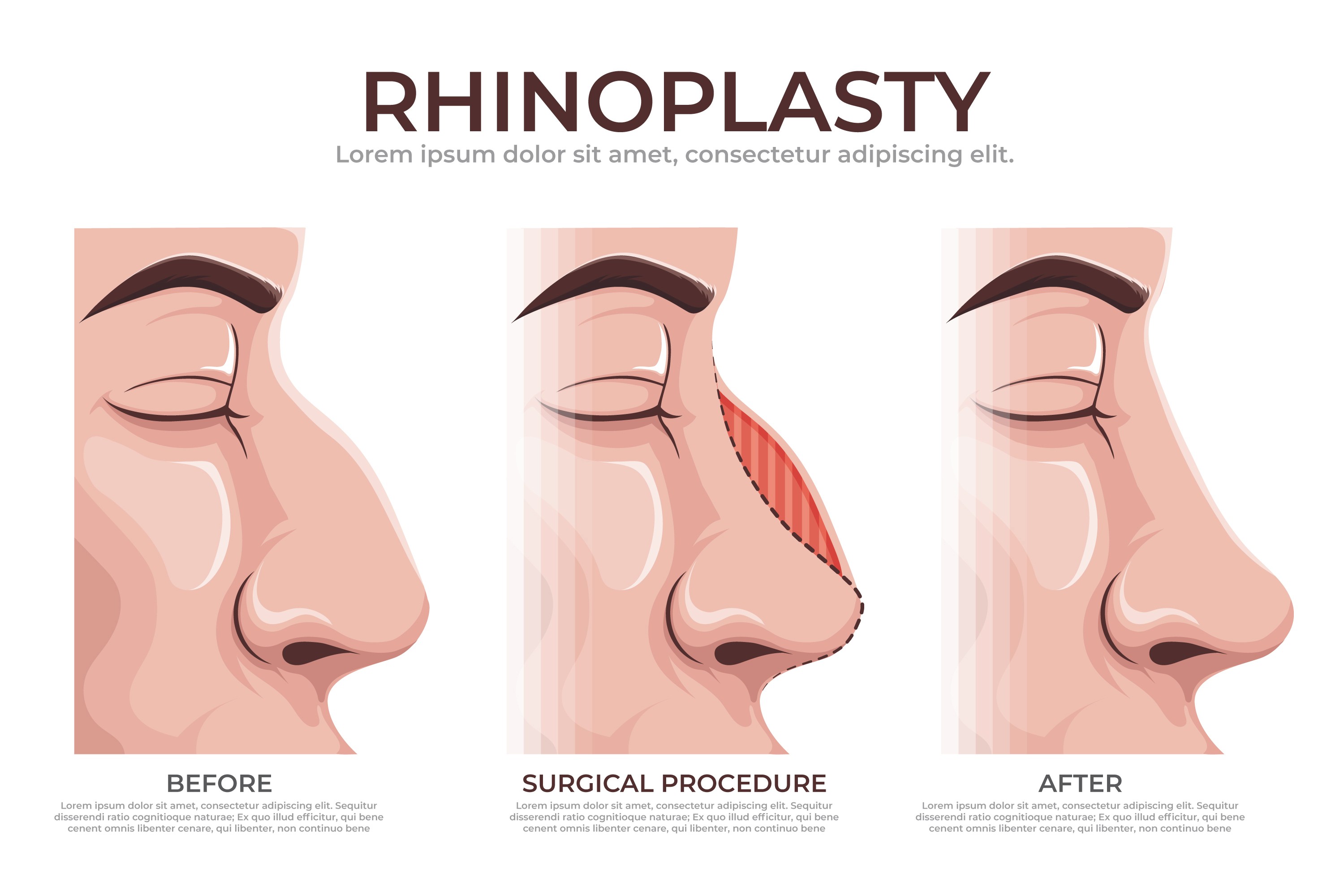 Patient receiving a facial aesthetic consultation treatment