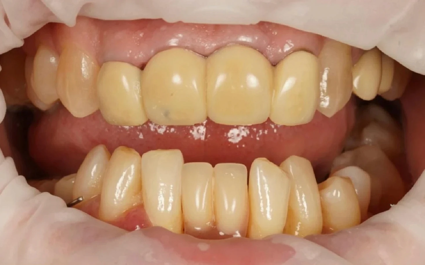 Image after