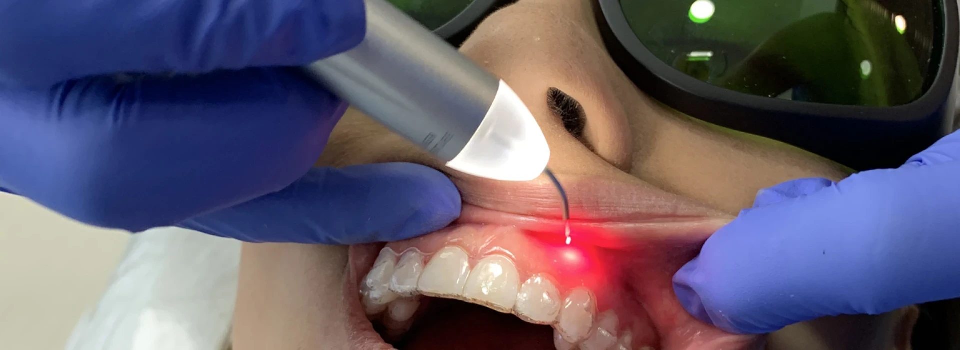 laser dentistry