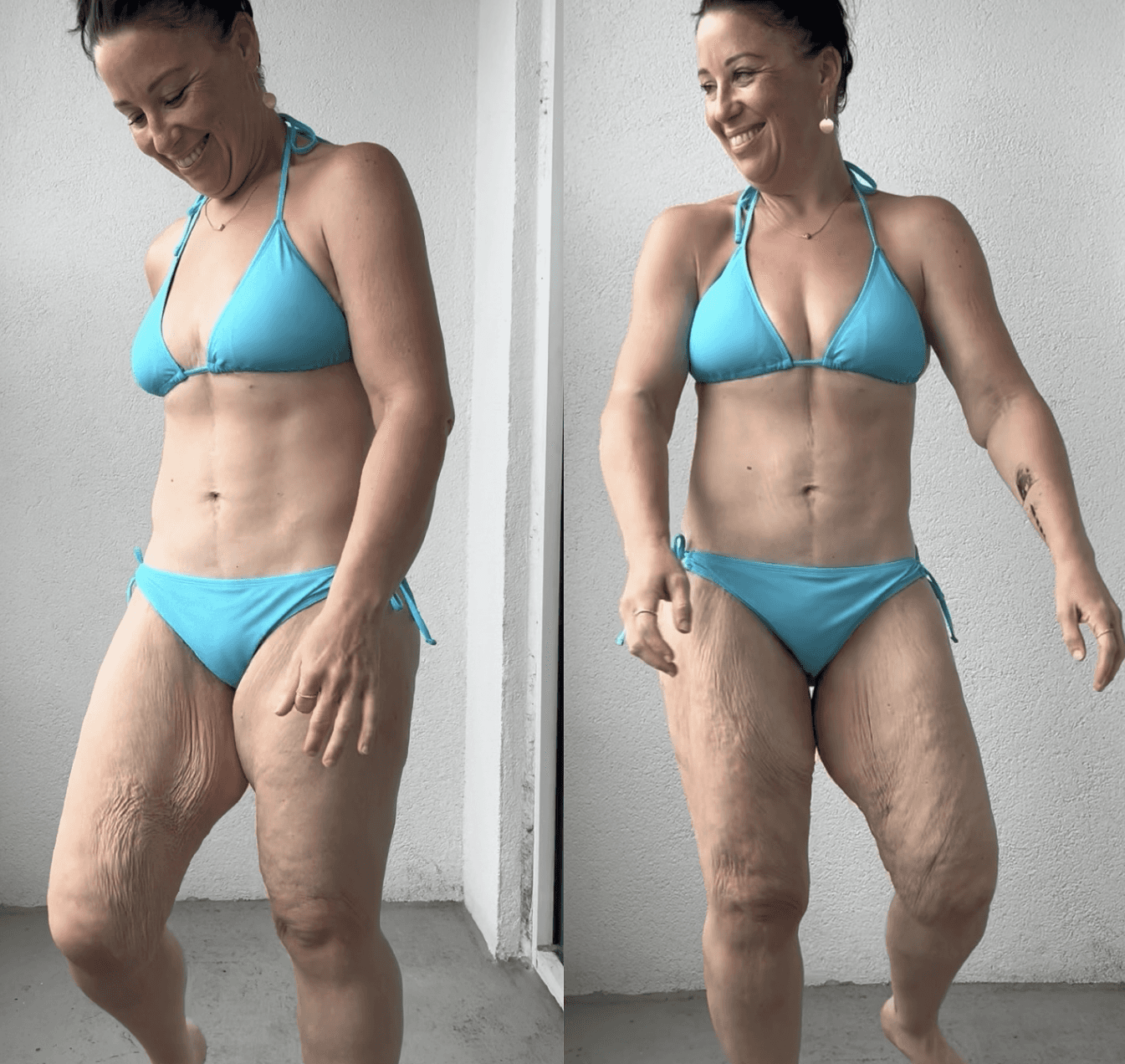 Before and after of surgery image