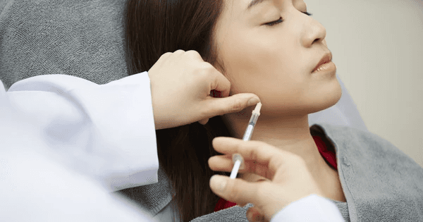 Ưu và nhược điểm của việc tiêm botox gọn hàm