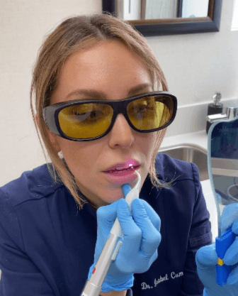 Cold Sore Treatment at ScarboroSmiles Dental Clinic in Scarborough, ON | Best dentist in Scarborough. 