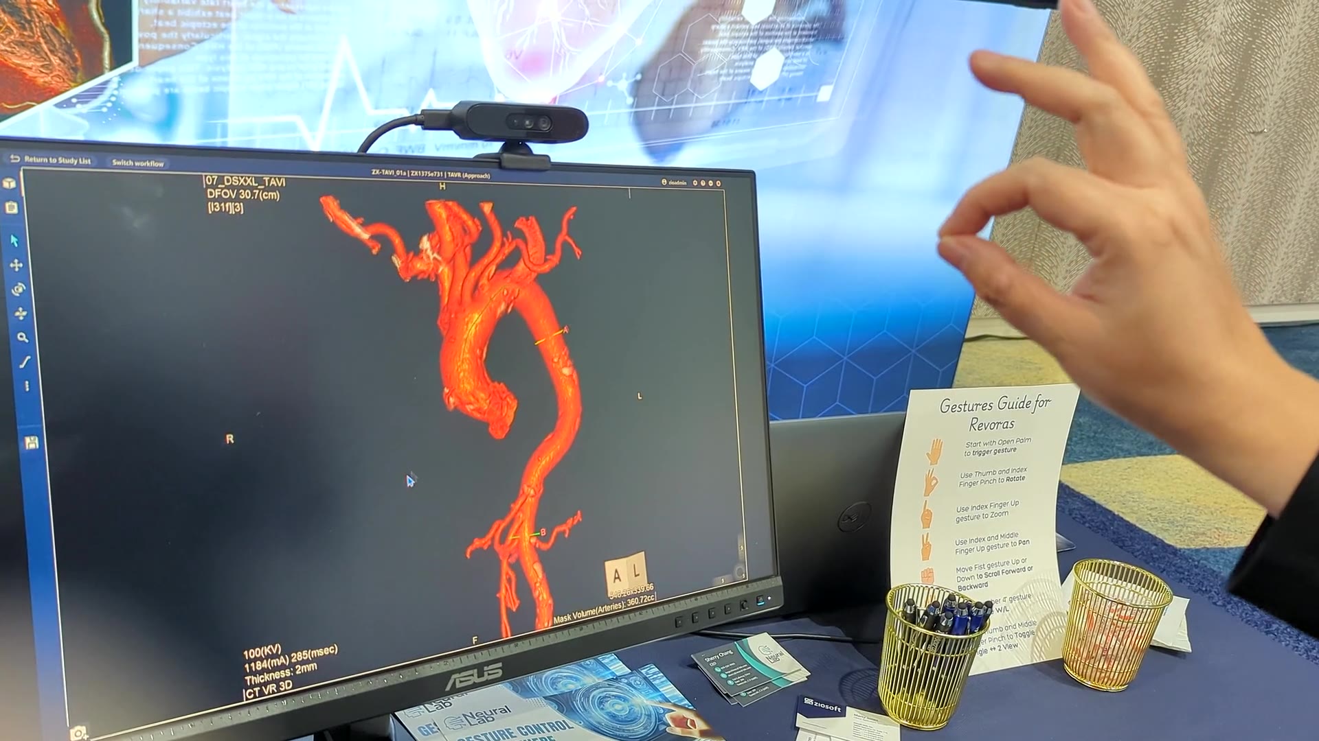 a webcam mounted on a monitor tracking a pinched hand gesture