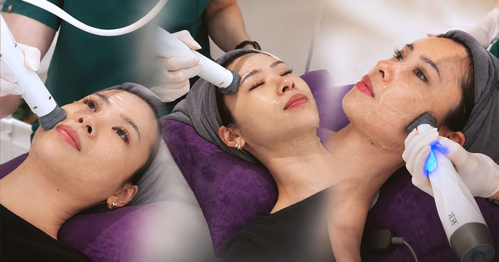 XERF skin tightening treatment performed on the face during a clinical procedure.
