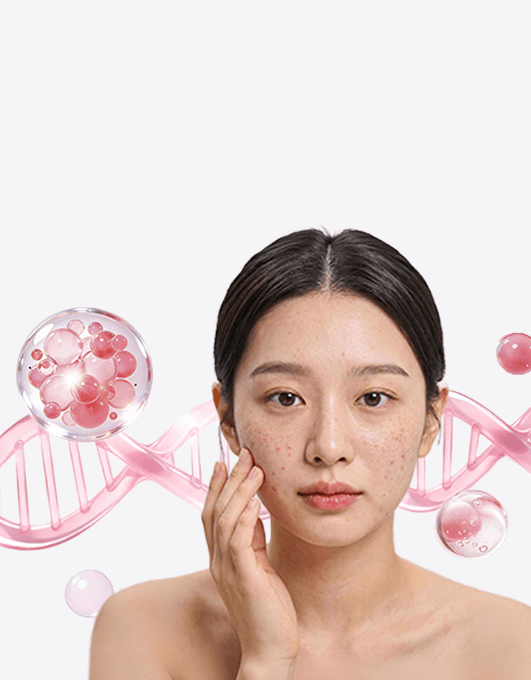 염증 개선을 위한 꼼꼼한 리쥬란 시술 | 뷰티스톤의원 홍대