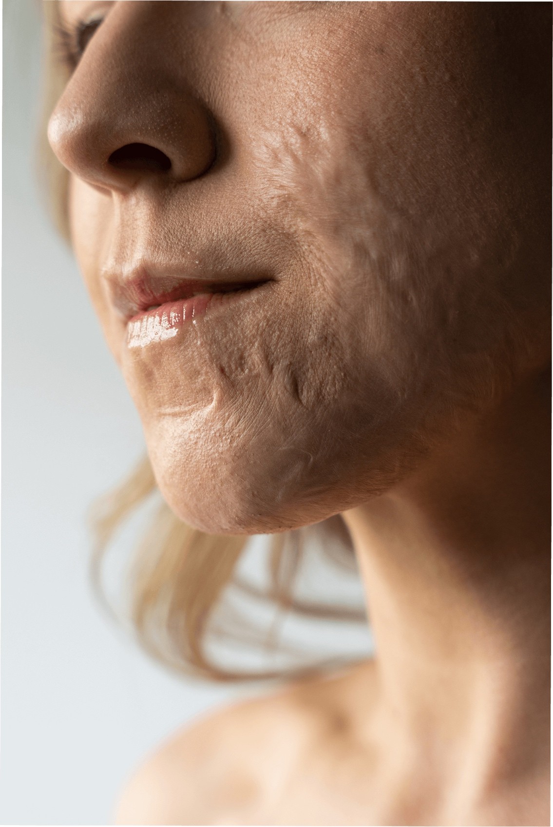 Sesja zdjęciowa dla Healthy Skin Clinic – detal twarzy, naturalna skóra z blizną