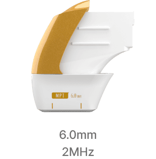 Ultraformer MPT cartridge 6