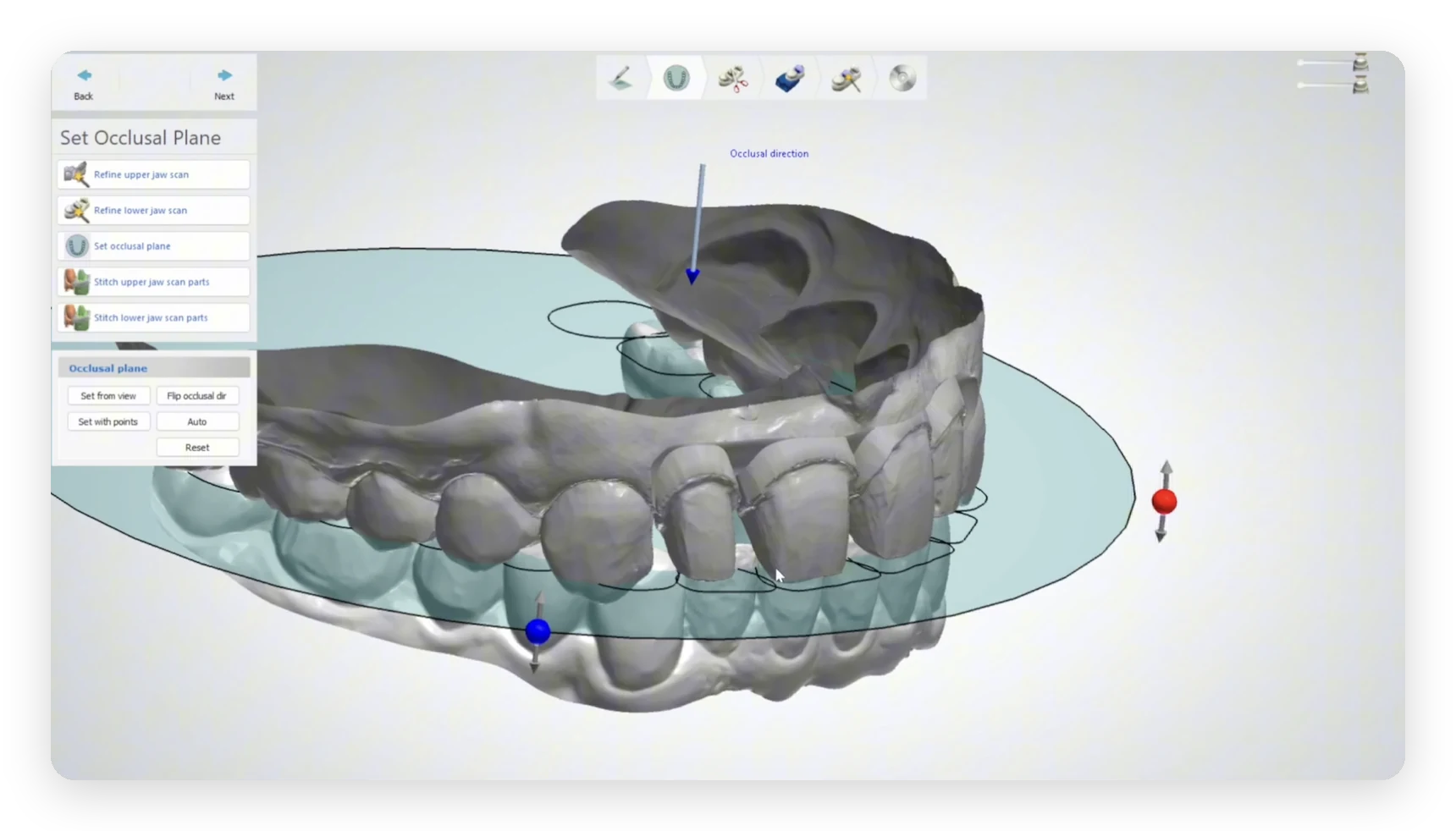 Setting the occlusal plane on upper and lower models in 3Shape Model Builder