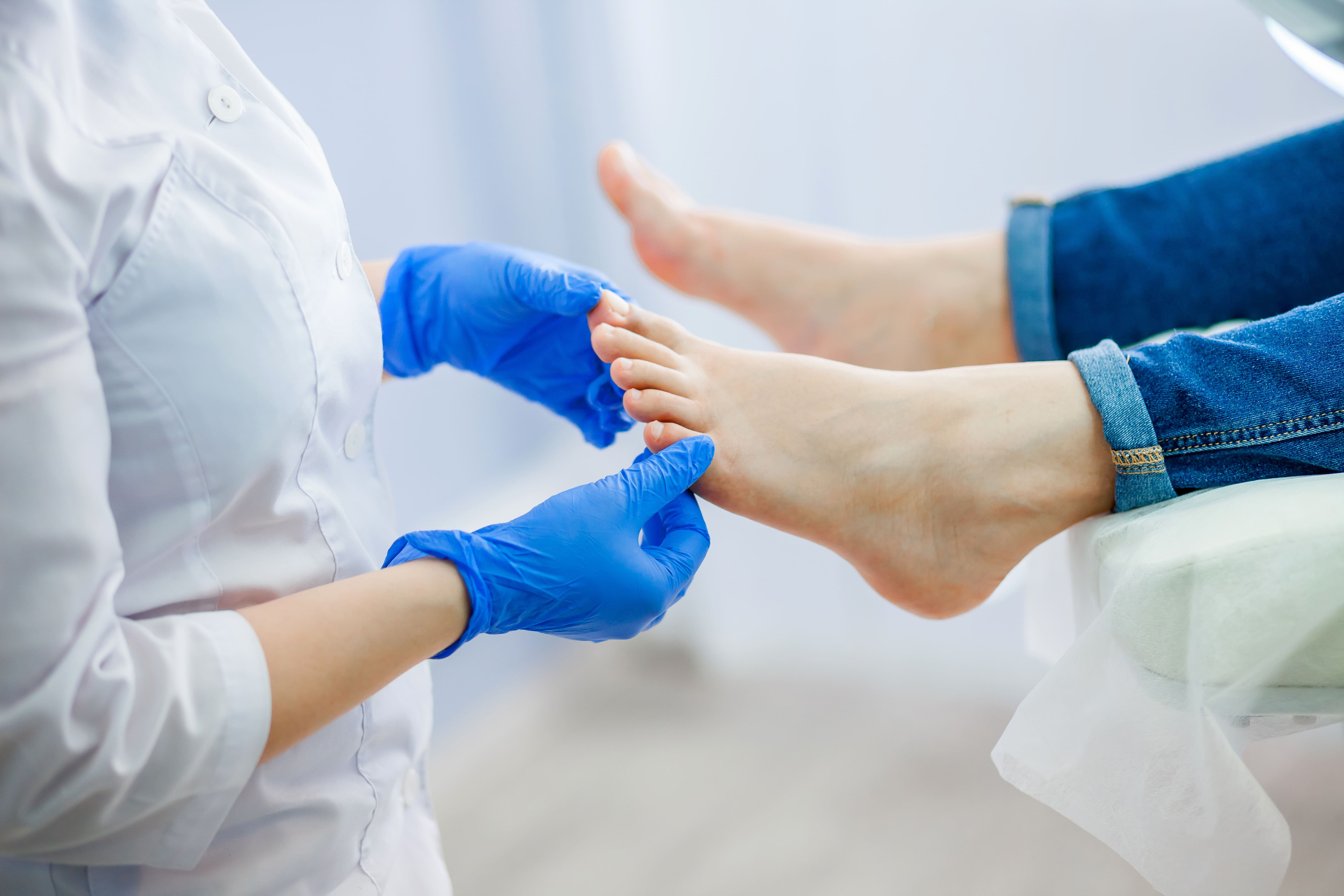Venous Stasis Ulcers
