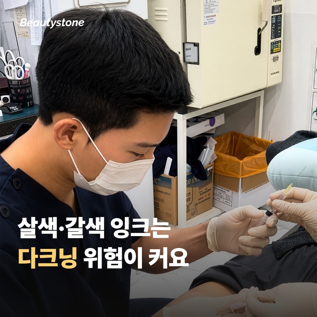 살색·갈색 잉크는 다크닝 위험이 커요