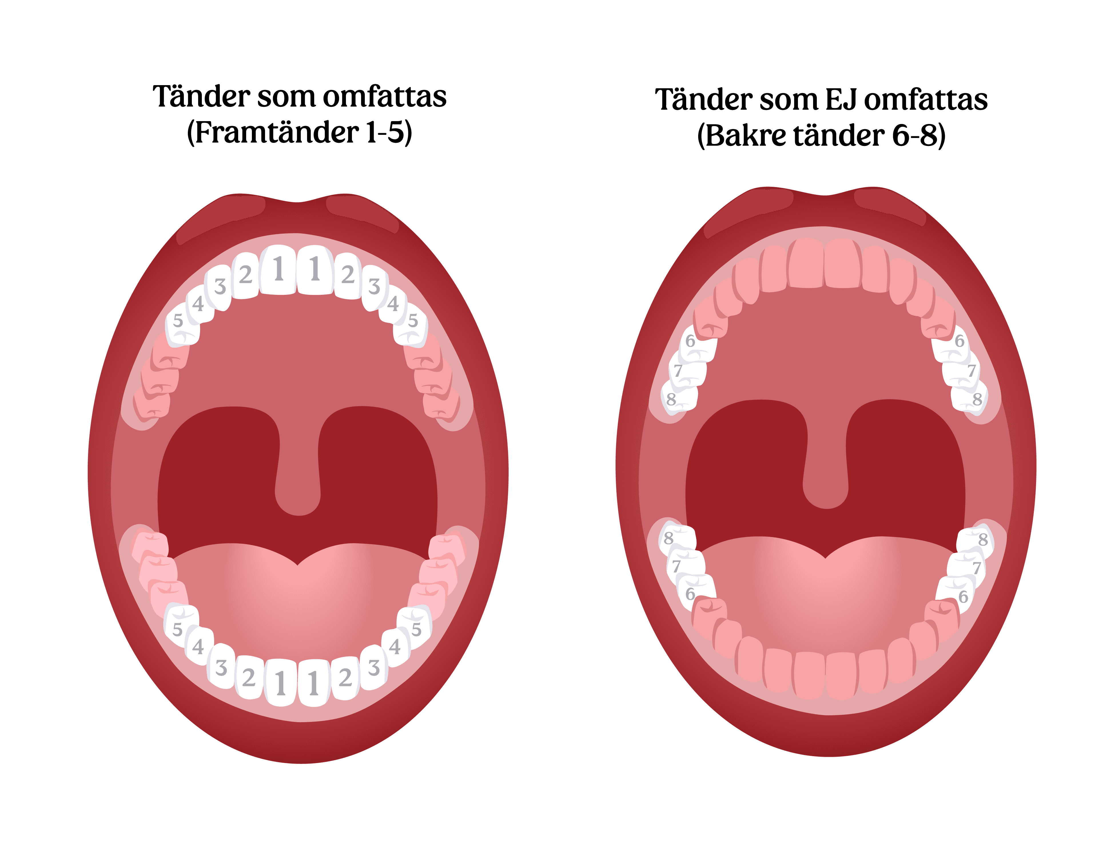 Illustration av två öppna munnar. Den vänstra visar framtänderna (tand 1–5) som omfattas av reformen, markerade i vitt. Den högra visar bakre tänder (tand 6–8) som inte omfattas av reformen.
