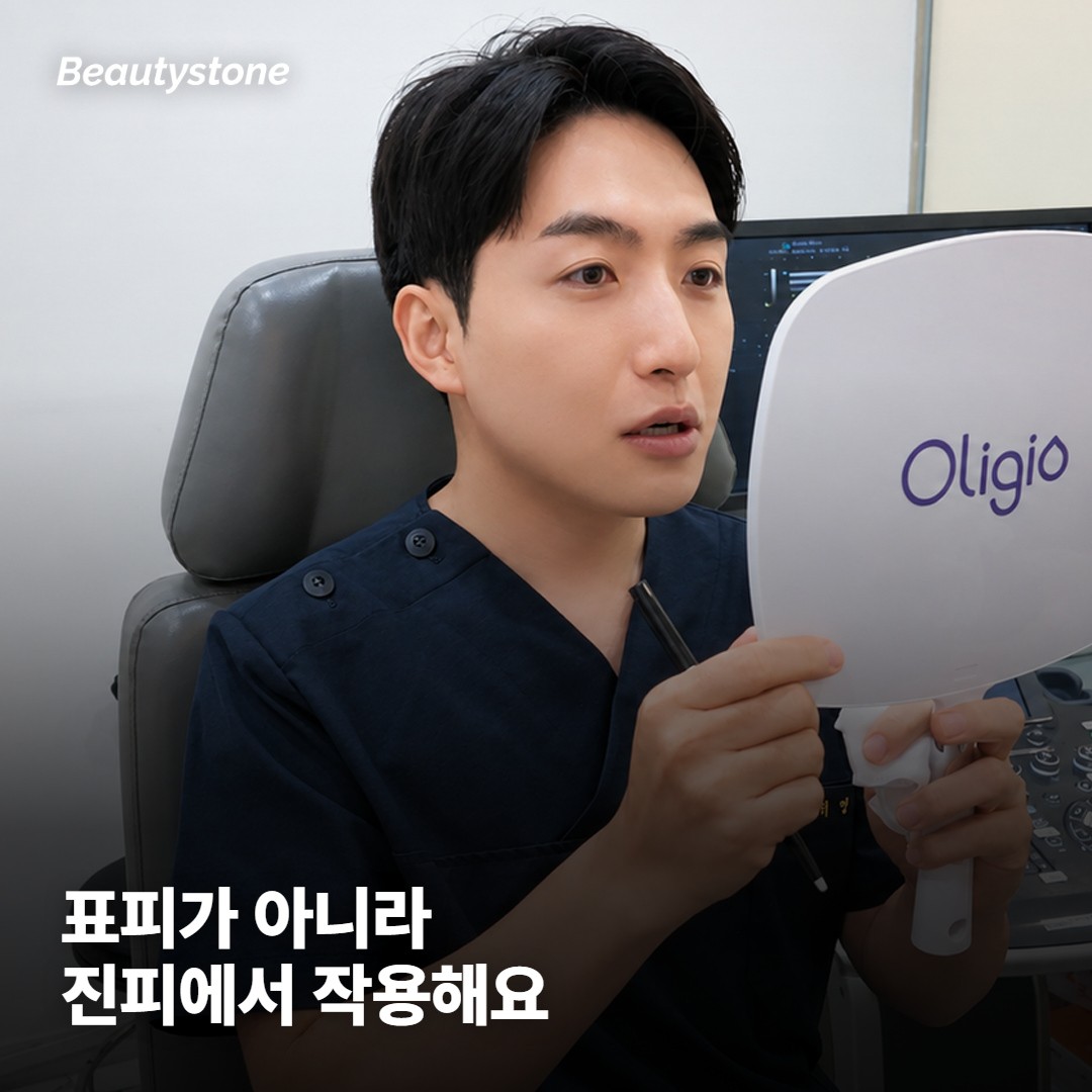 수분 채우는 계열과 재생 유도하는 계열의 곡선 차이