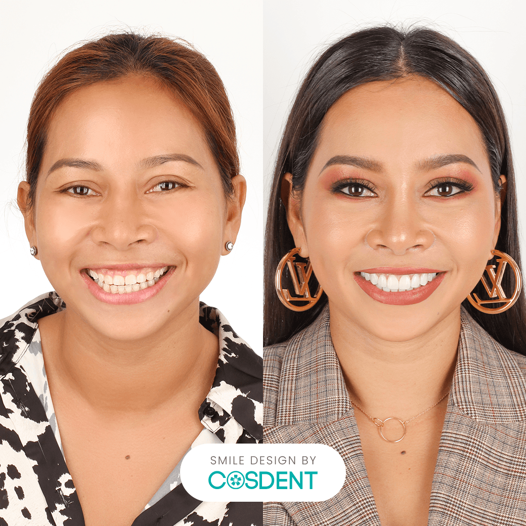 หน้าไทย ยิ้มกว้าง 19 ซี่