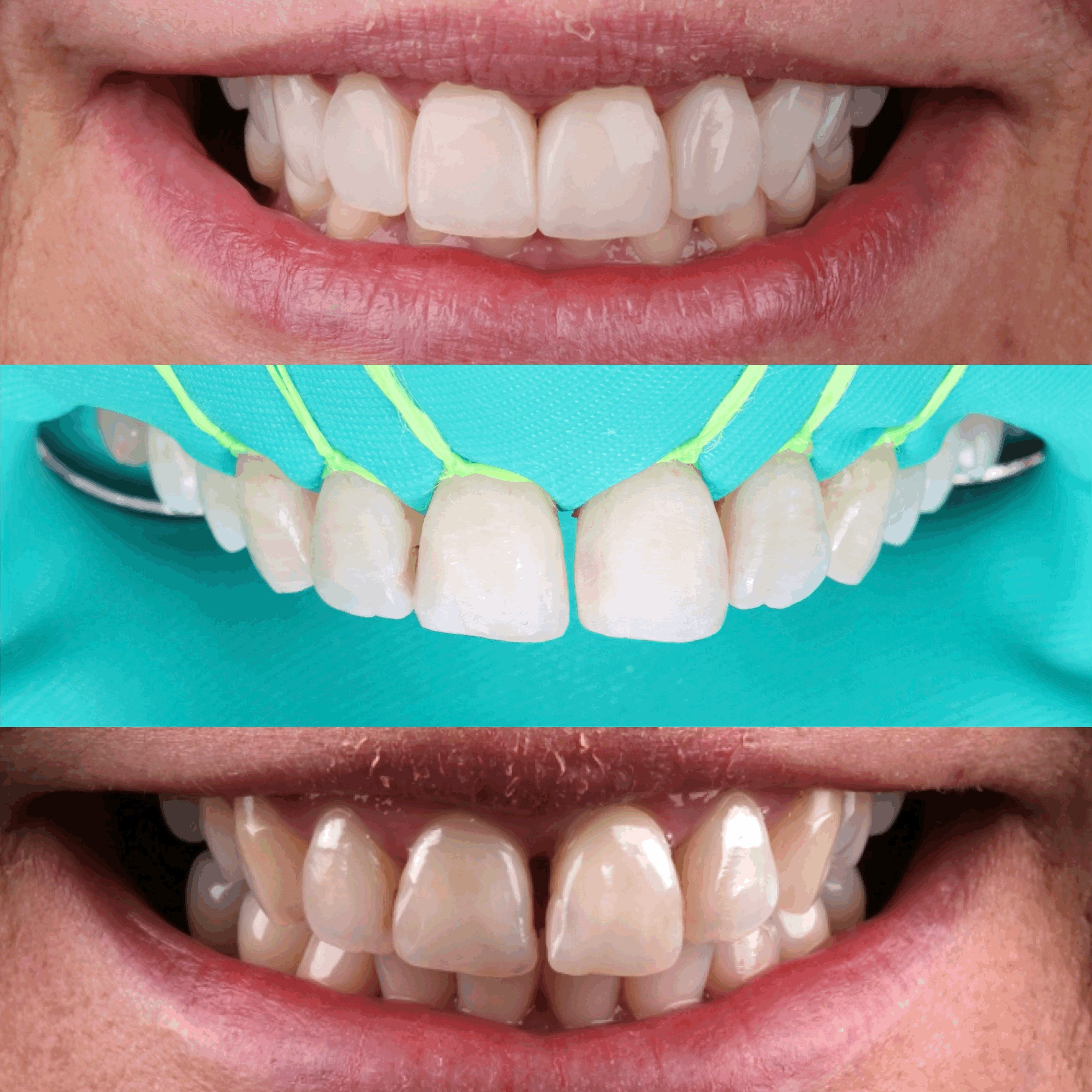 5 Common Skincare Mistakes to Avoid