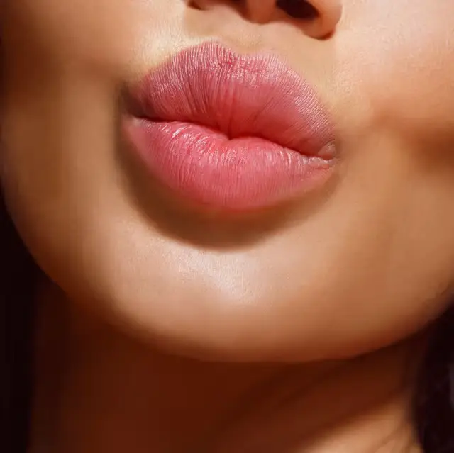 Best HA Lip Filler for Your Goals: Natural Volume, Shape & Symmetry