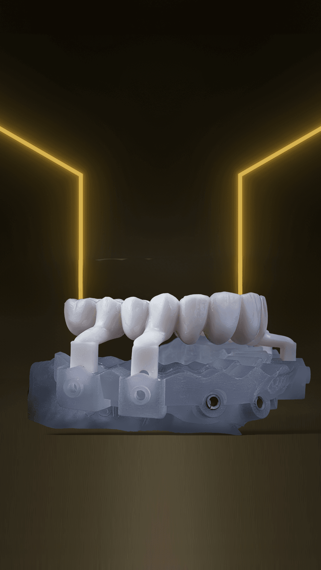 Digital Treatment Planning