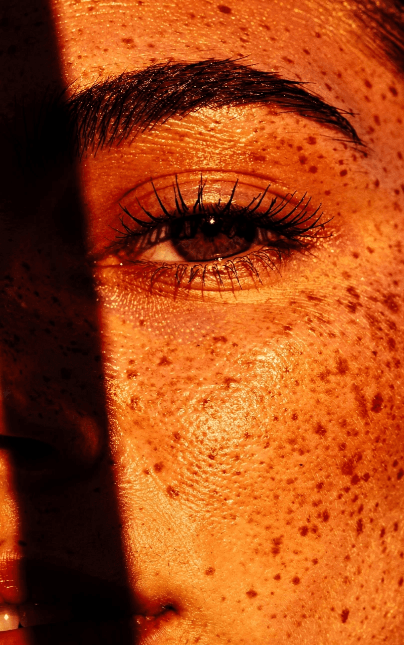 Close-up of a person's freckled face, focusing on one eye under dramatic light casting a shadow. The image conveys warmth and intrigue.