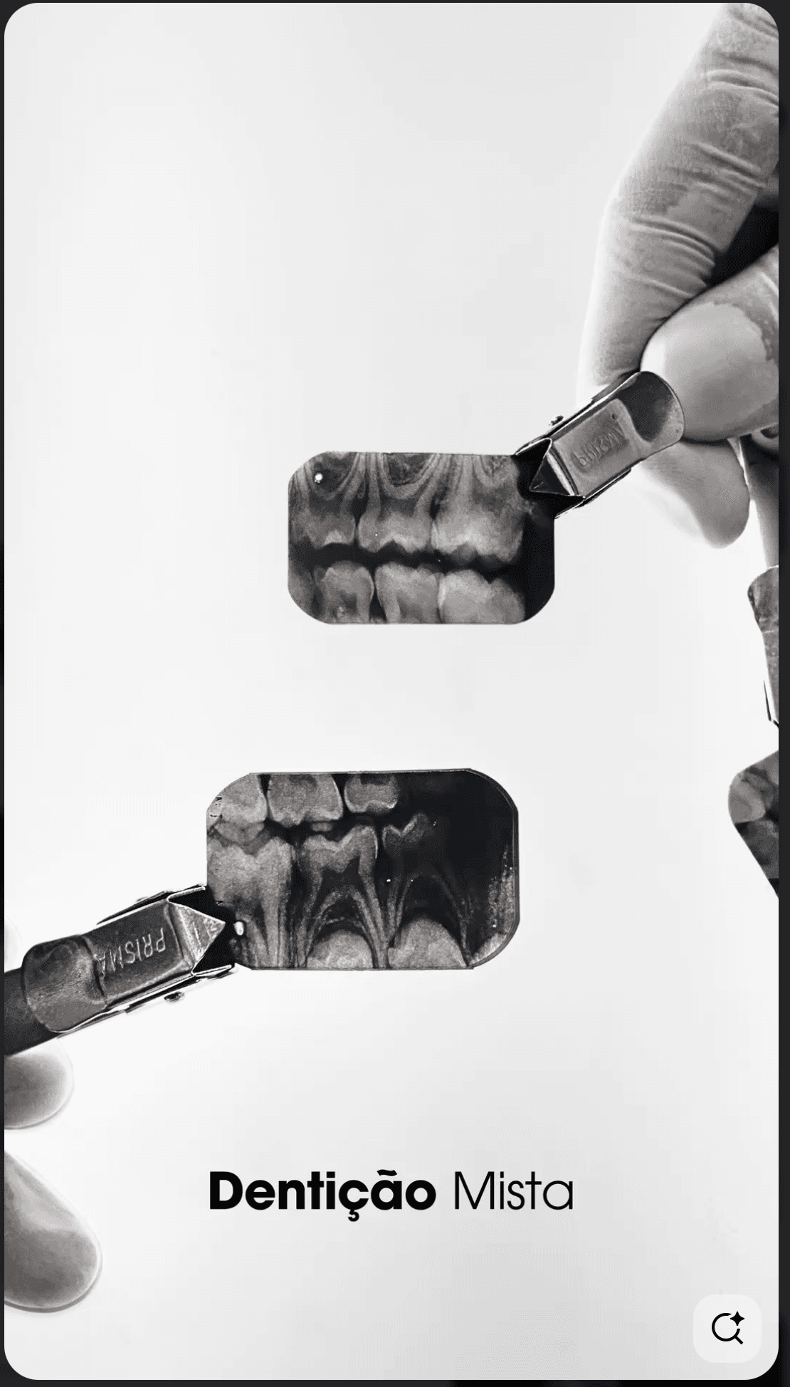 Zwei Zahnröntgenbilder von gemischter Dentition, gehalten von Zahnarzthelfern