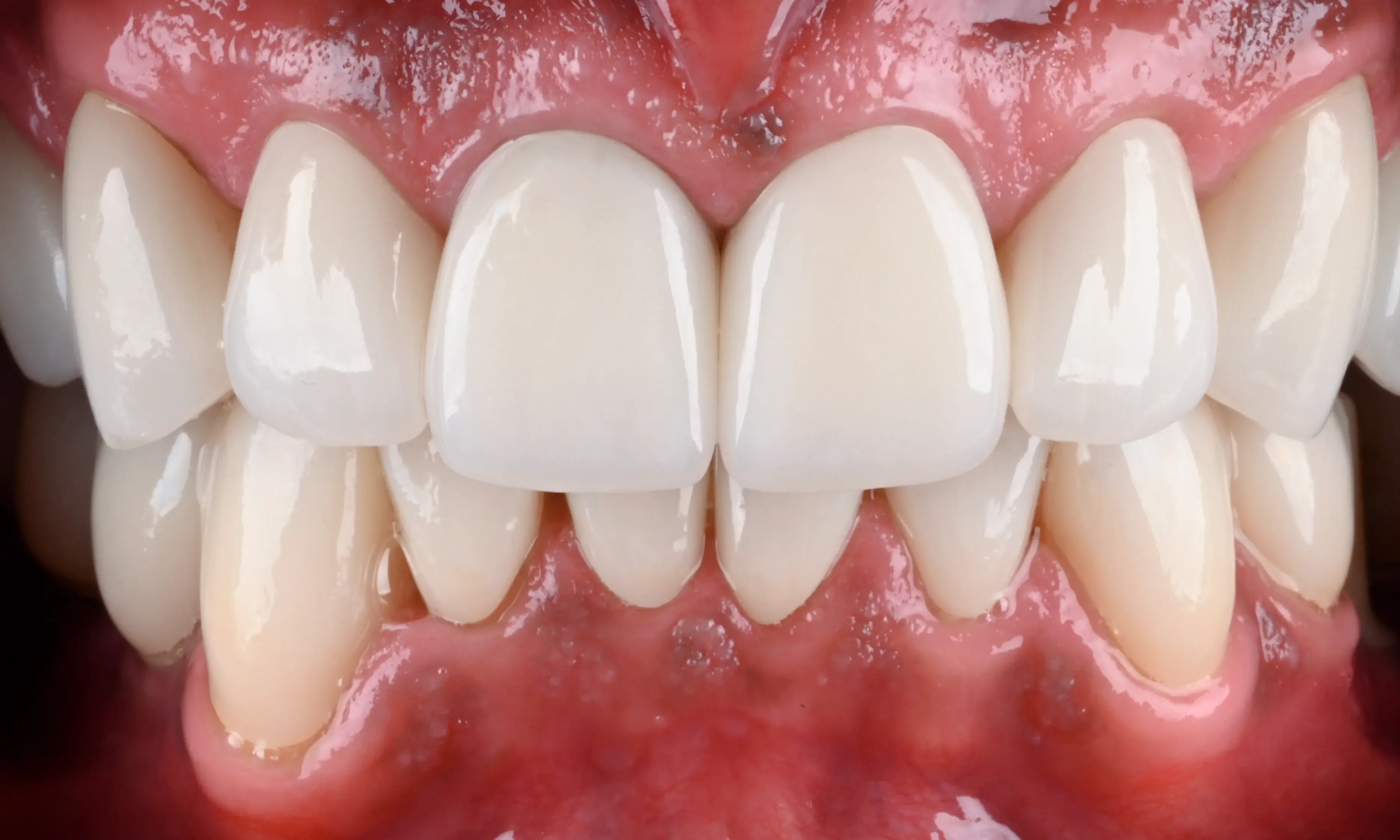 Foto mit Polarizationsfilter