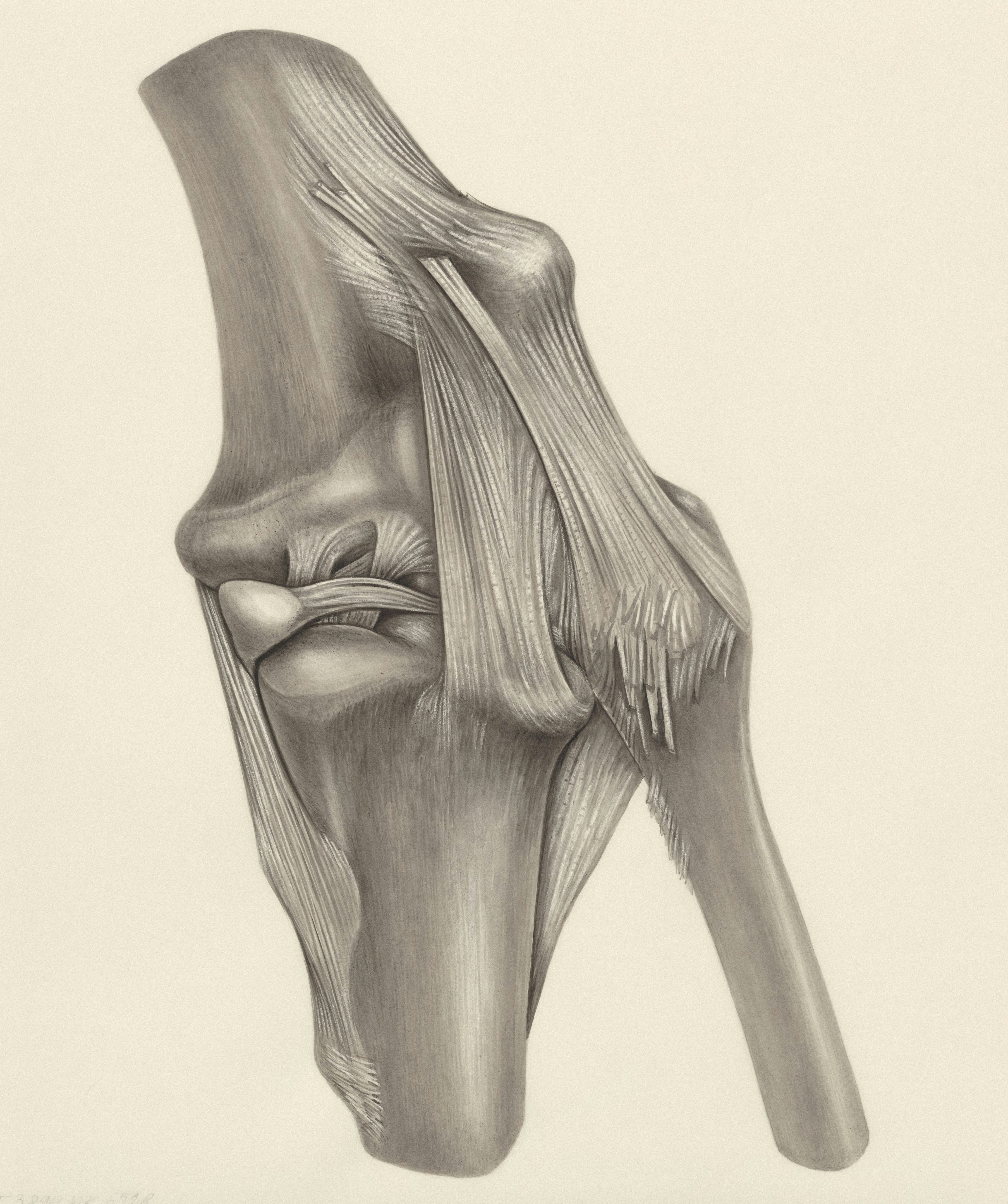 diagram of the muscle tissue which is the root cause of ACL