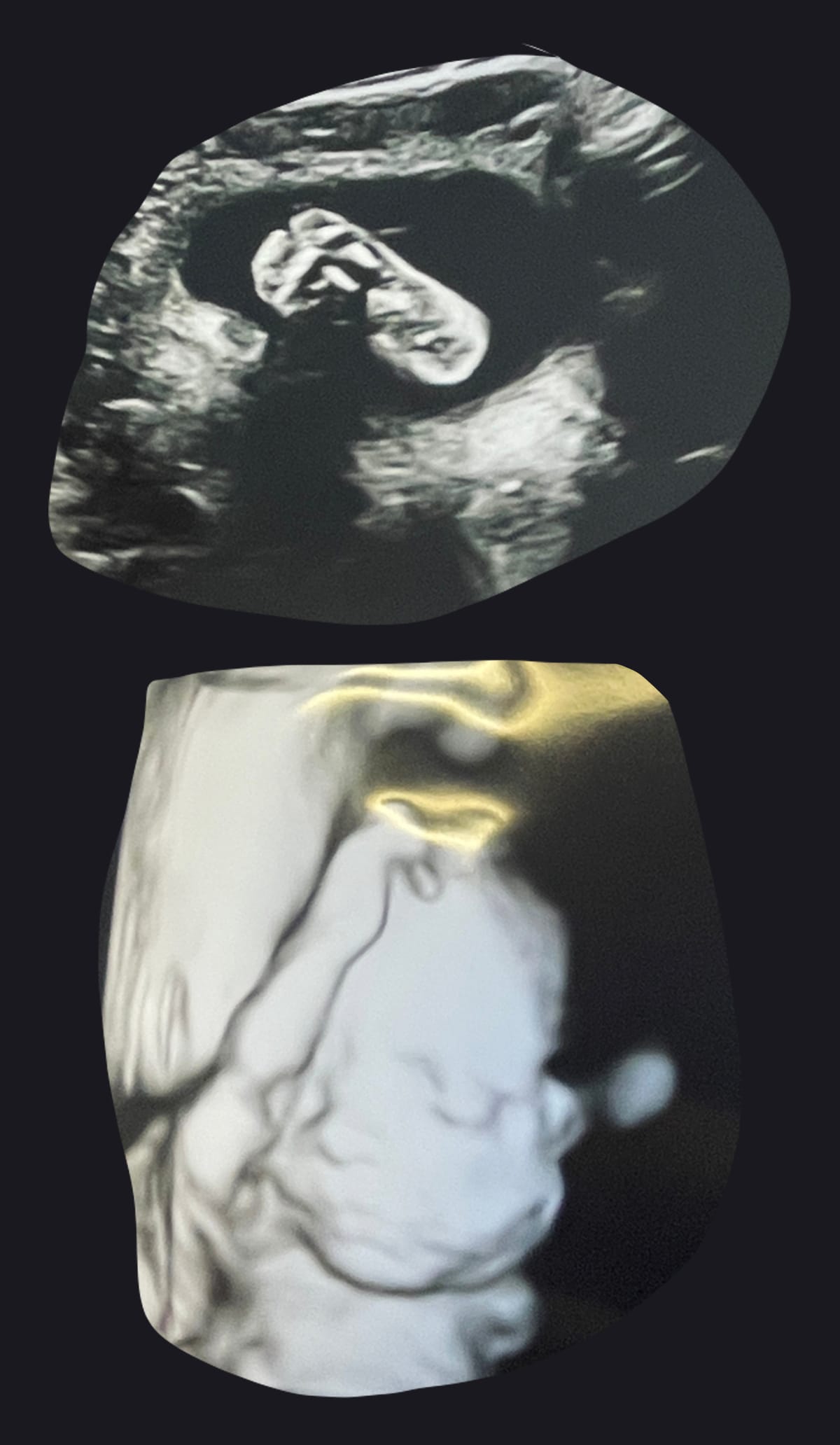 22 weeks