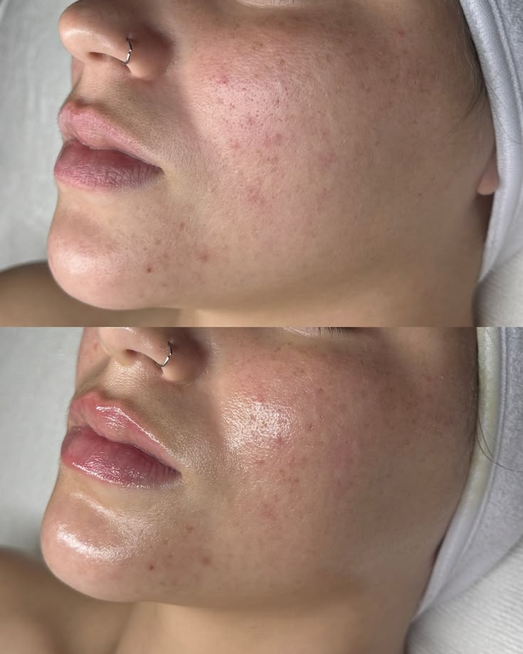 Before and after lash extension comparison, natural to full volume.