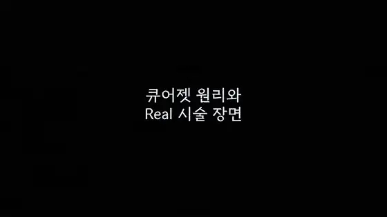 큐어젯 시술 과정과 통증,   실제로 어떤가요?