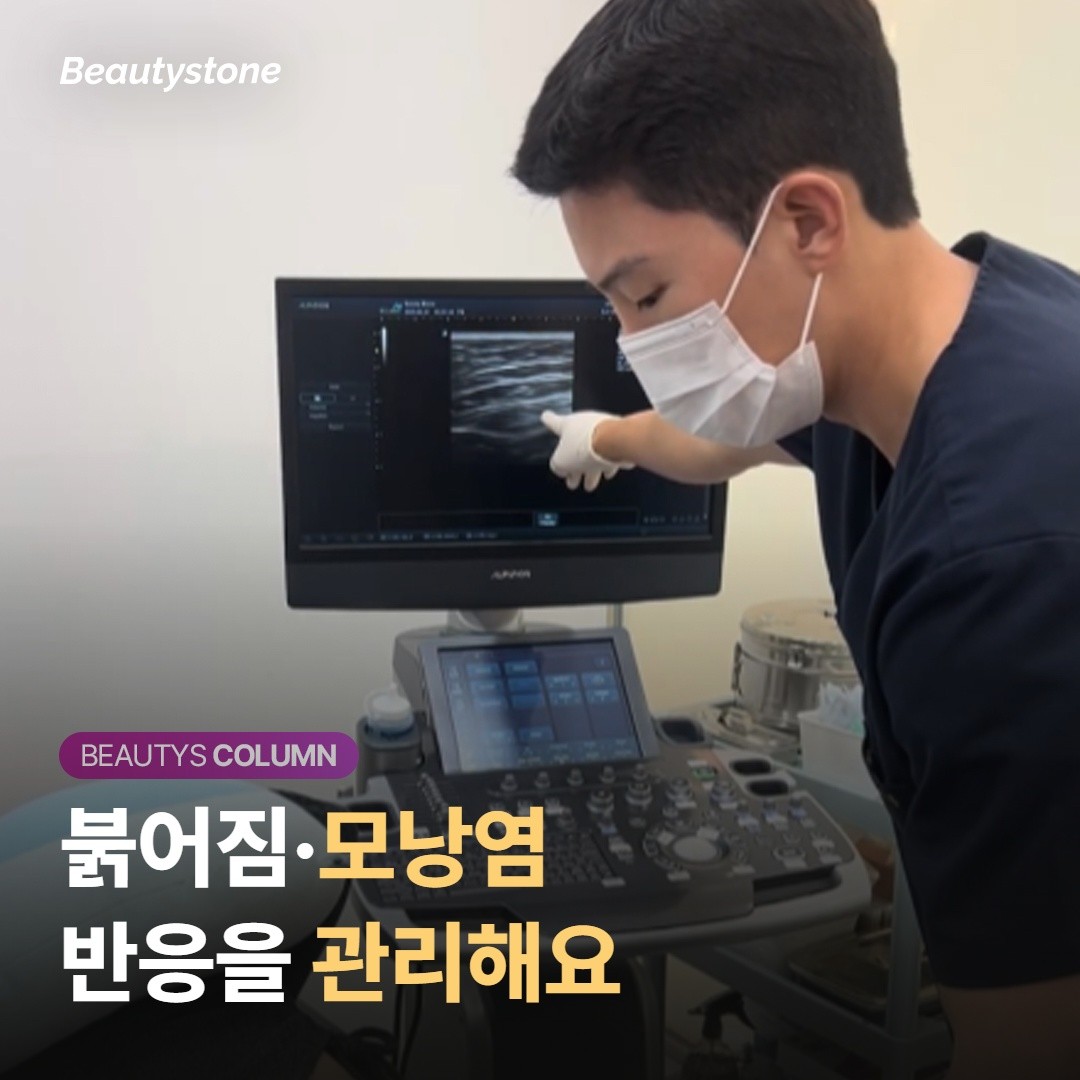 자극과 부작용 관리