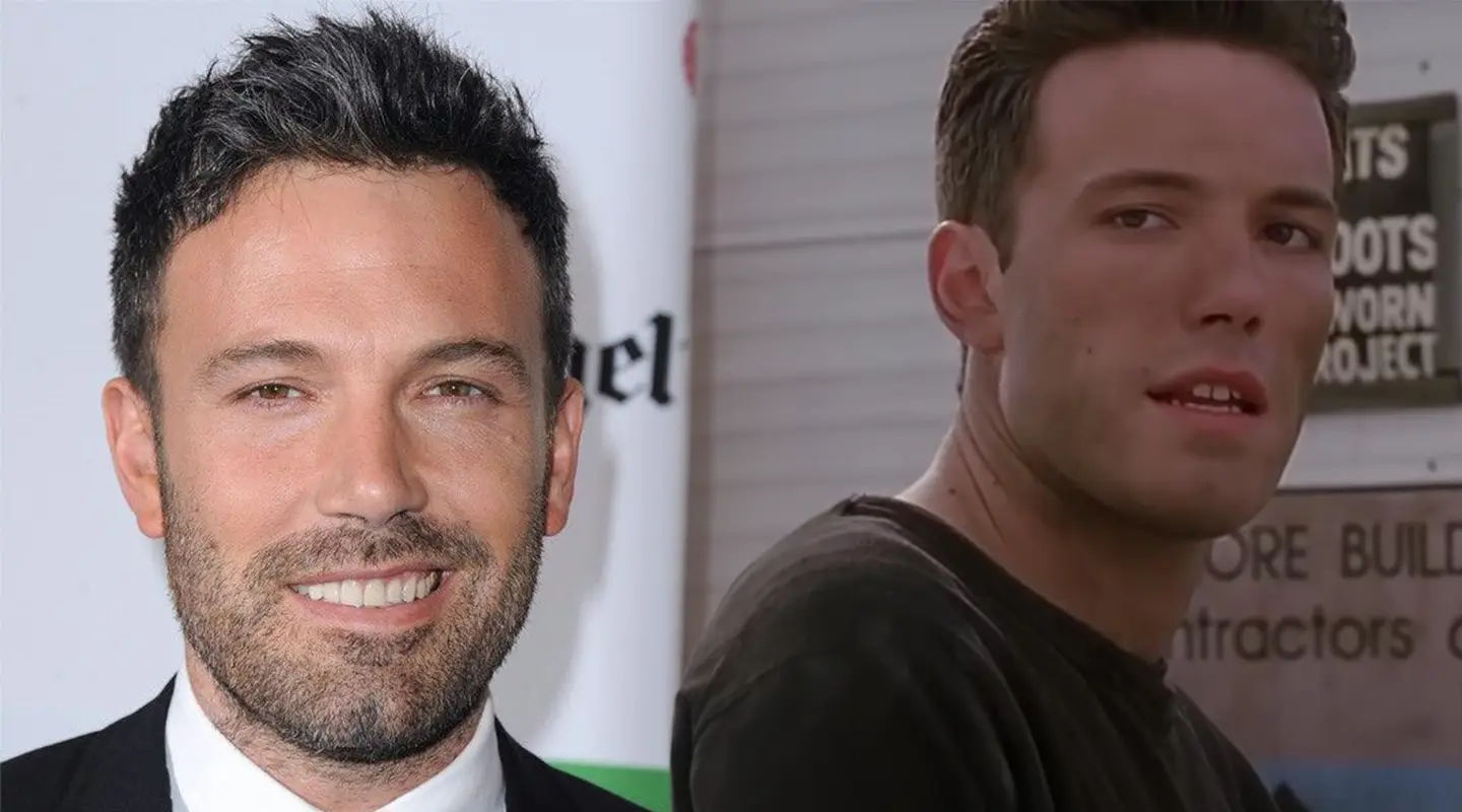 Ben affleck smile before and after