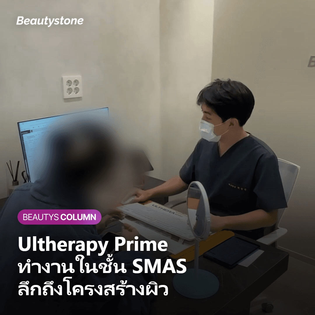 Ultherapy Prime ทำงานในชั้น SMAS ลึกถึงโครงสร้างผิว