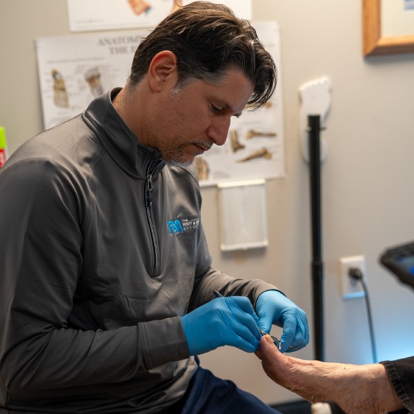 Outer Ankle Conditions