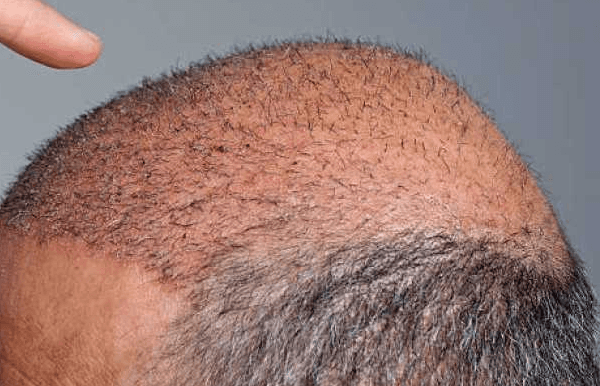 man standing beside wall