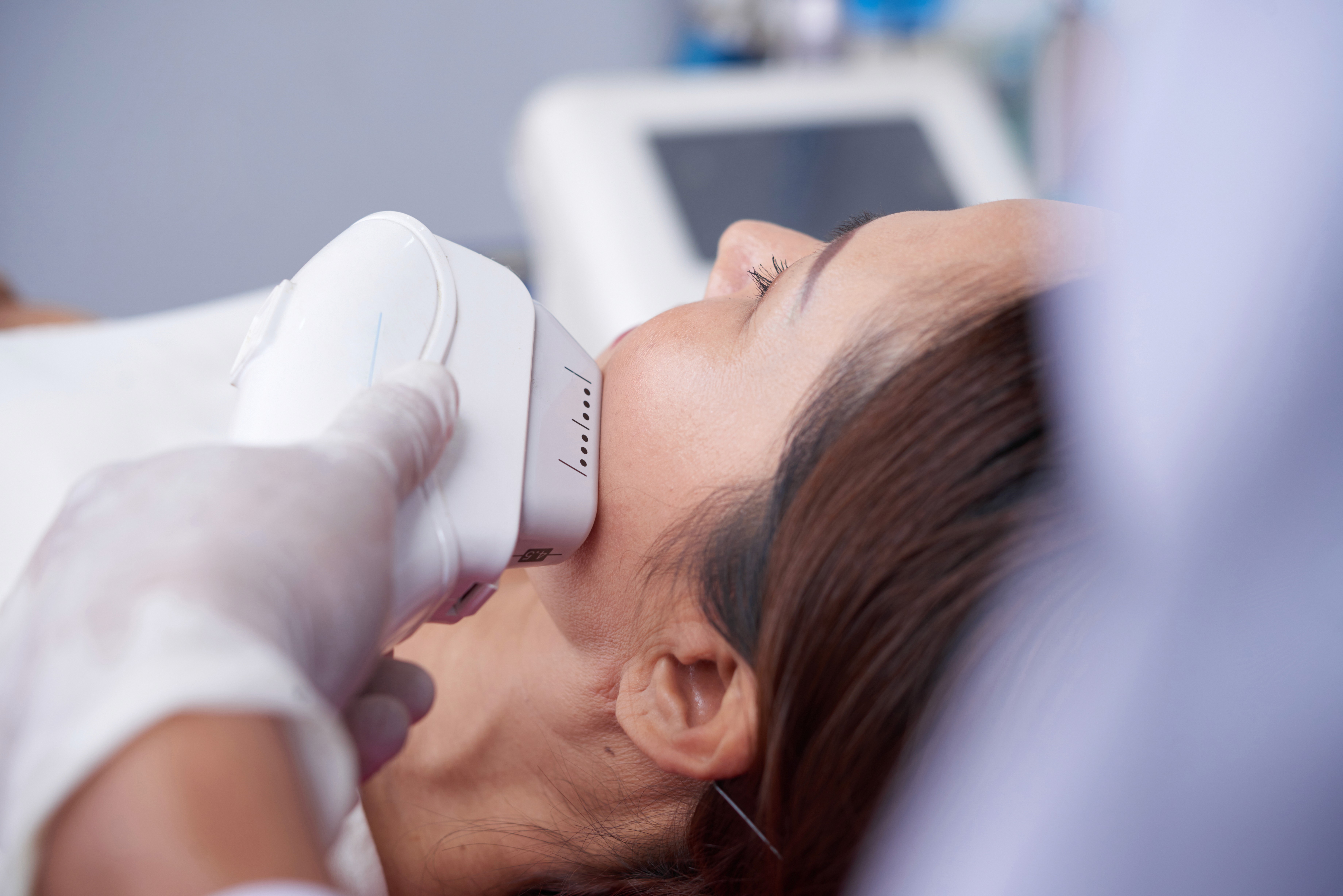 Laser treatment on woman's cheek with protective eye shield