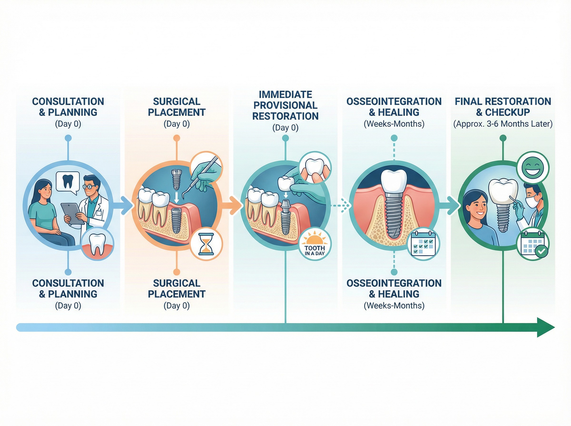 Before and after same-day dental implant showing missing tooth replaced with natural-looking restoration at Smyrna Dental Studio