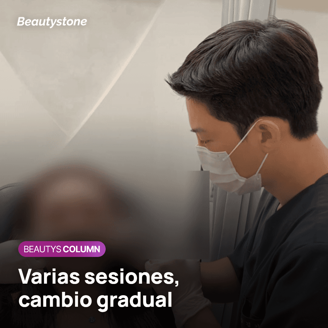 Varias sesiones, cambio gradual