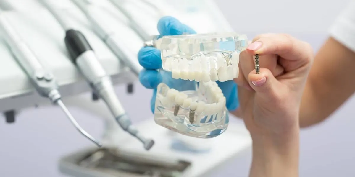 dental implants maintenance