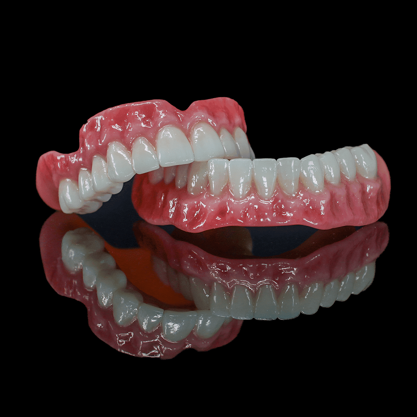 veneers