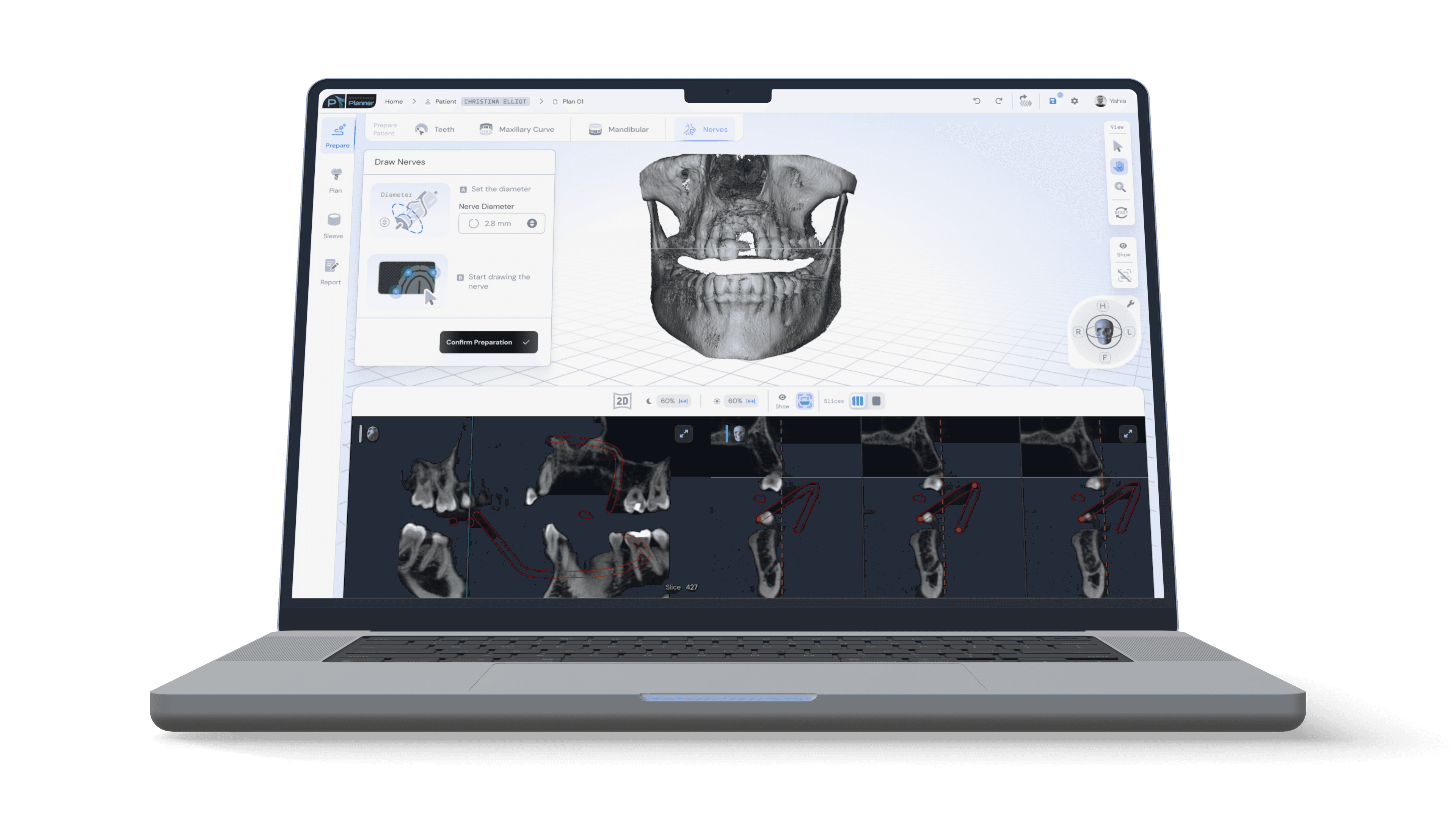 Laptop with digital dentistry software