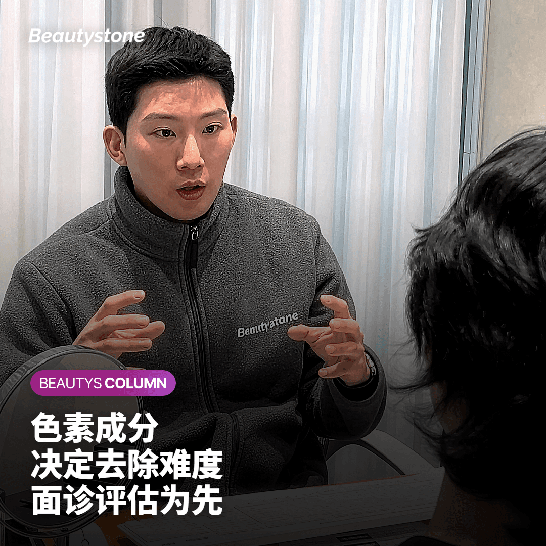 激光设备与参数选择