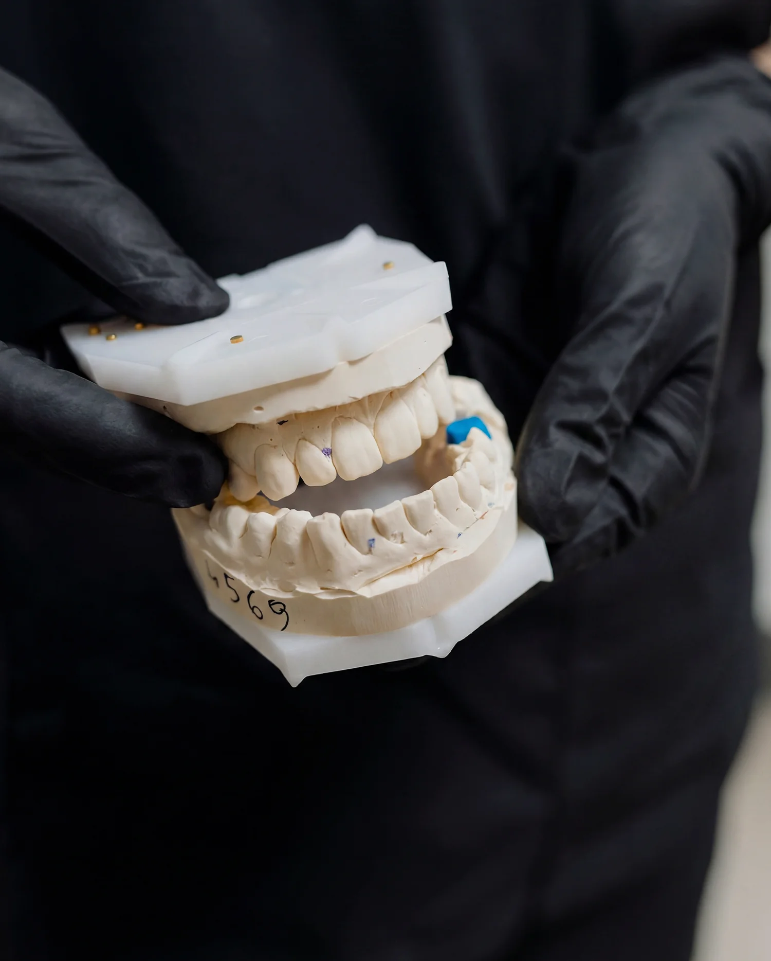 Close-up of a dental model used to explain oral surgery and restorative treatment options to patients.
