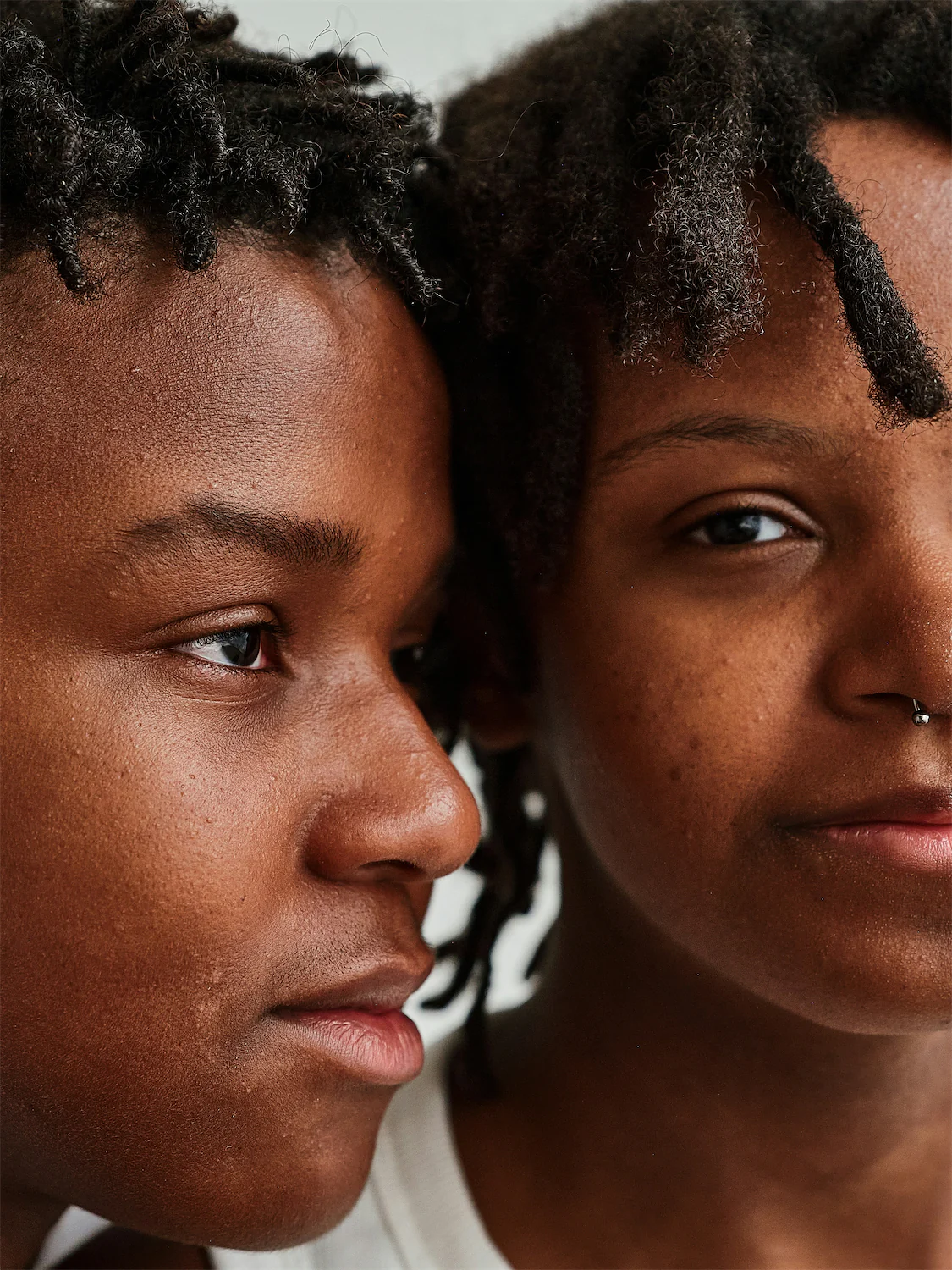 acne and eczema