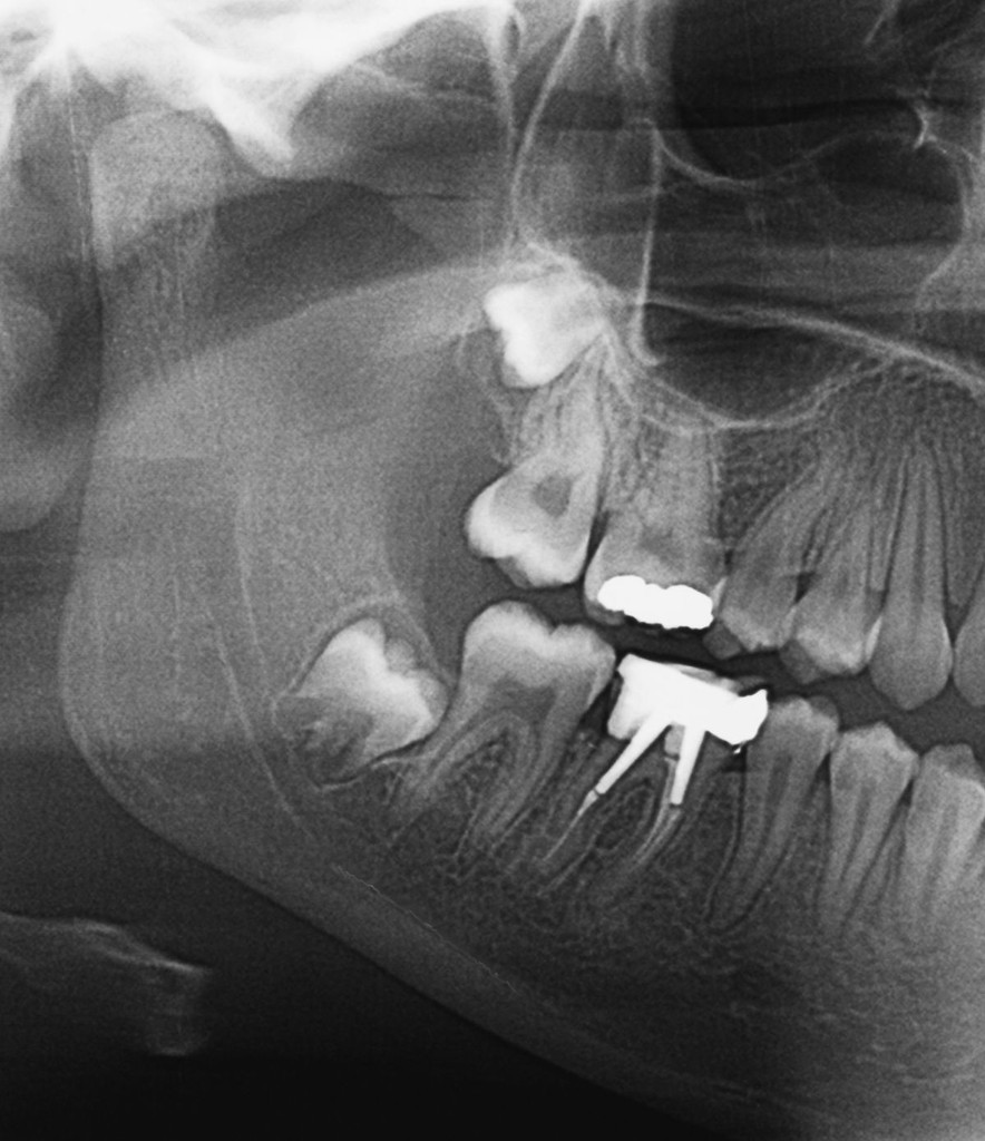 Teeth Checkup