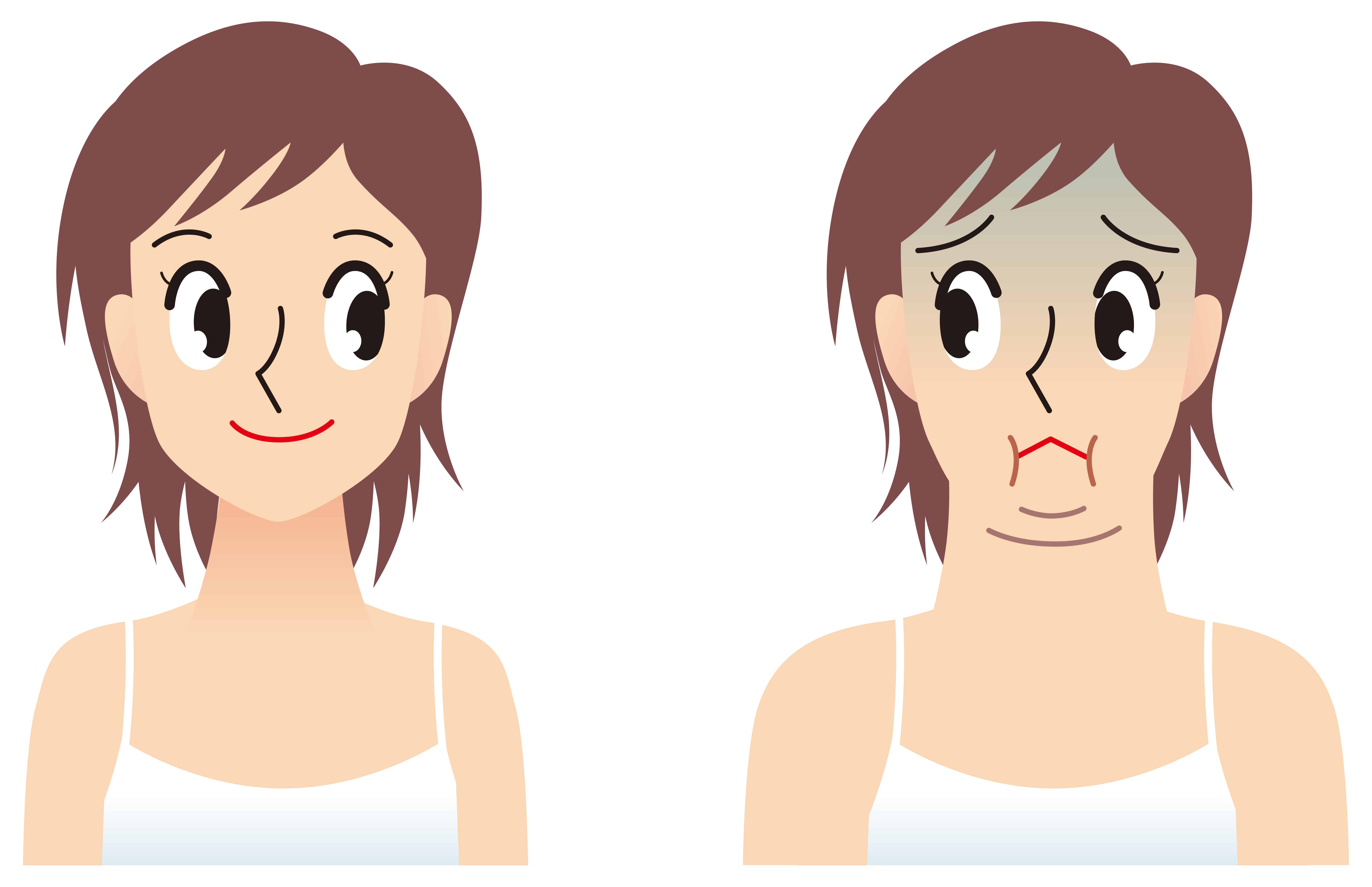 Can Posture Fix Double Chin A Comprehensive Guide PostureFix
