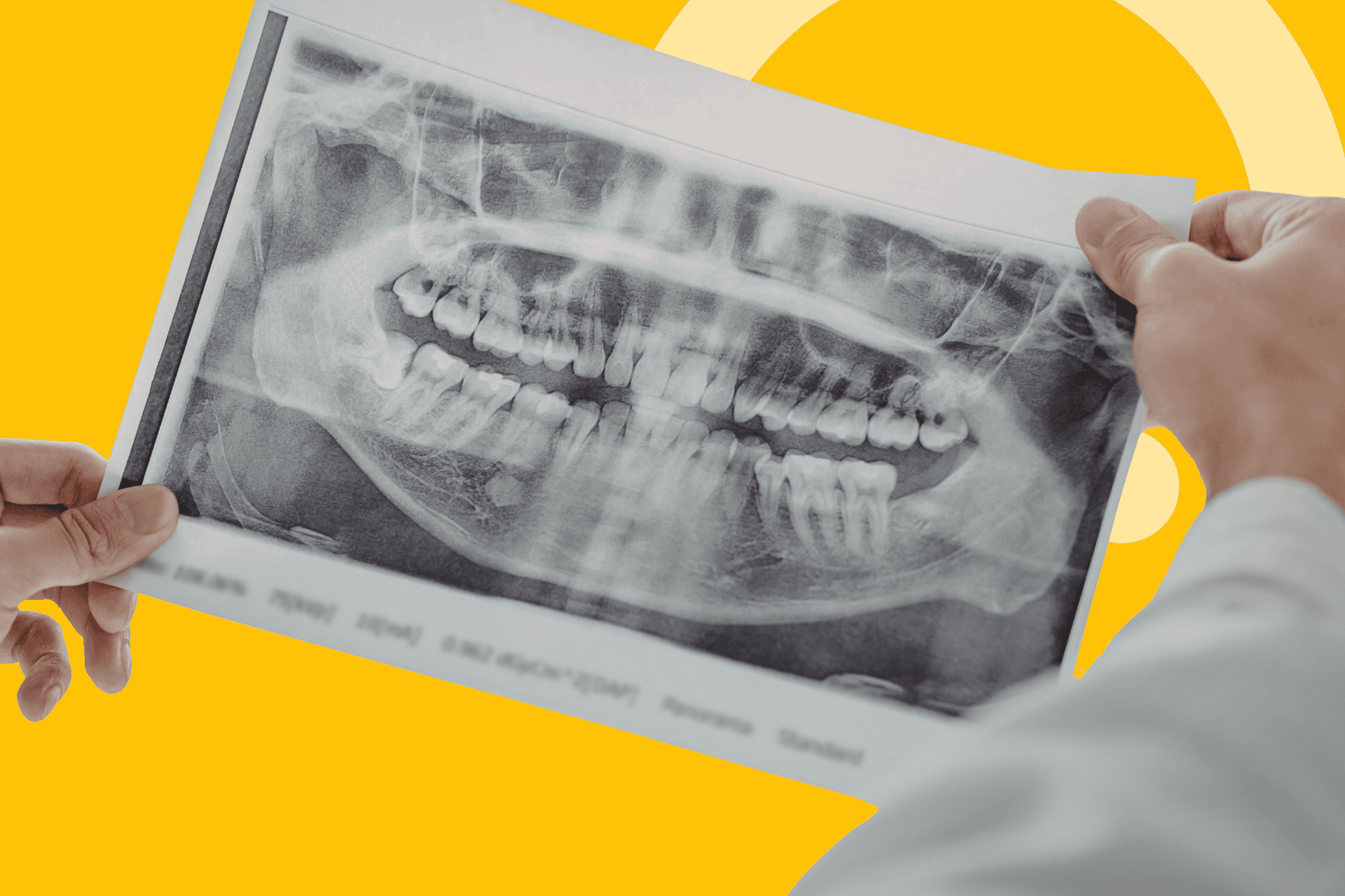 manos de un doctor revisando una placa radiográfica dental