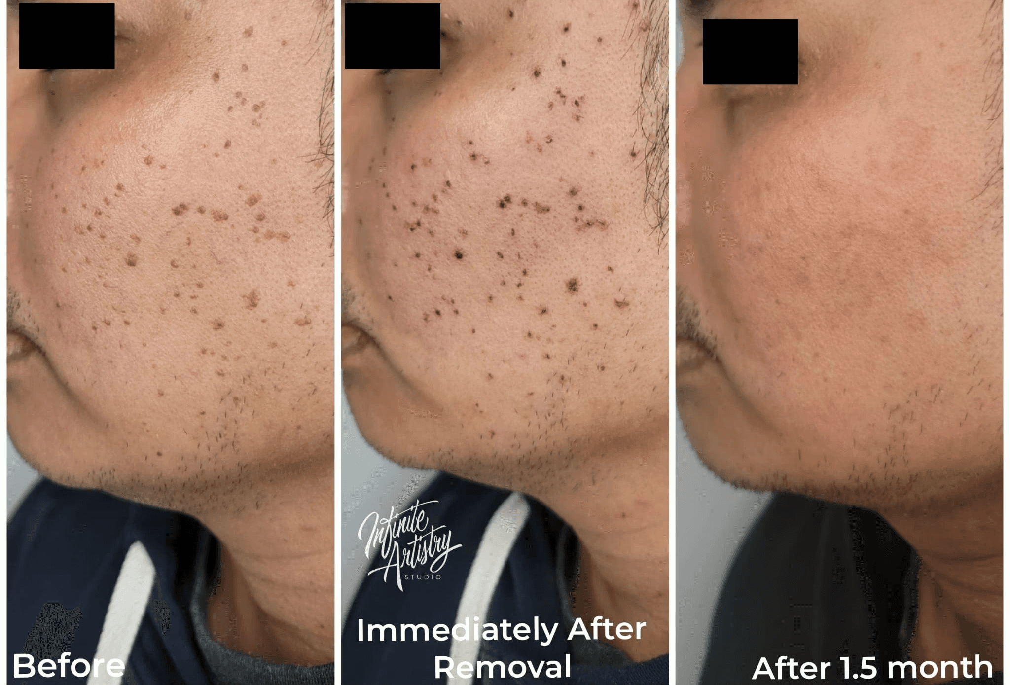 Another 1 Barbershop Fade Haircut